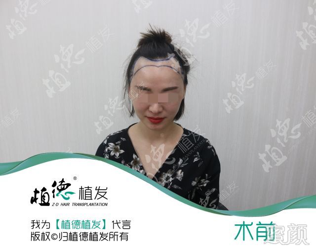 https://img.miyanlife.com/mnt/timg/180325/133G03141-10.jpg