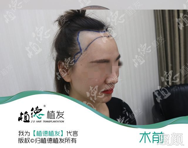 https://img.miyanlife.com/mnt/timg/180325/133G0HL-12.jpg