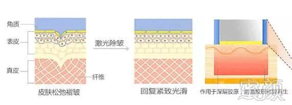 案例图片