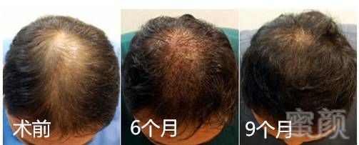 https://img.miyanlife.com/mnt/timg/180326/1112552R8-6.jpg