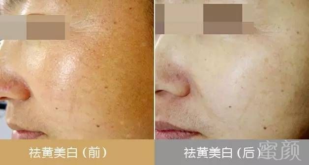 https://img.miyanlife.com/mnt/timg/180326/1116442421-5.jpg
