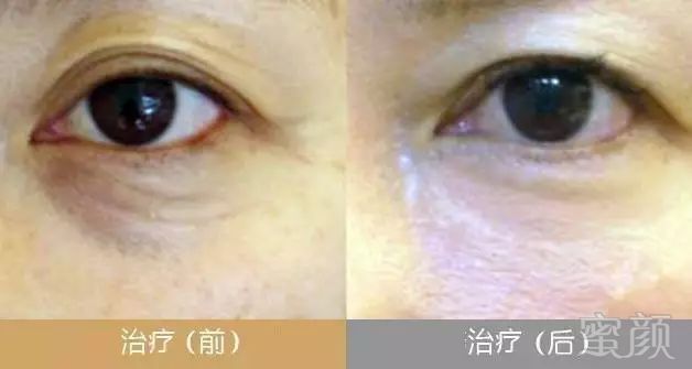 https://img.miyanlife.com/mnt/timg/180326/1116442U1-8.jpg