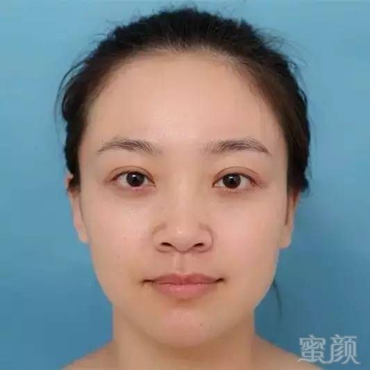 https://img.miyanlife.com/mnt/timg/180326/112354G59-9.jpg