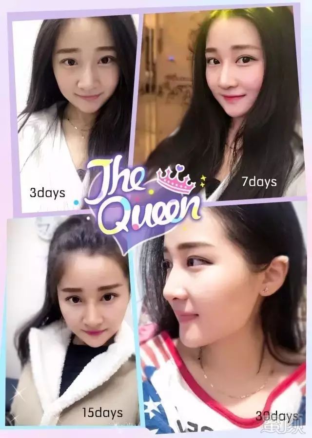 https://img.miyanlife.com/mnt/timg/180326/11235G062-13.jpg