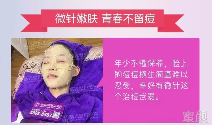 https://img.miyanlife.com/mnt/timg/180326/1125512S3-6.jpg
