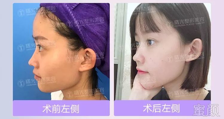 https://img.miyanlife.com/mnt/timg/180326/11255142S-4.jpg