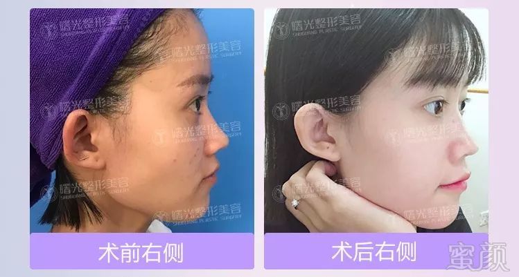 https://img.miyanlife.com/mnt/timg/180326/112551K22-5.jpg