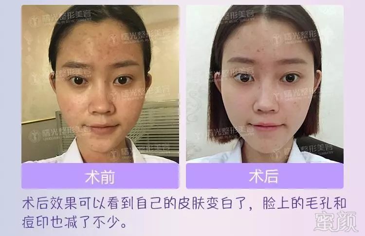 https://img.miyanlife.com/mnt/timg/180326/112552A64-7.jpg
