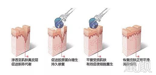 https://img.miyanlife.com/mnt/timg/180326/112600G01-11.jpg