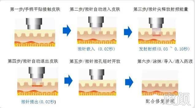 https://img.miyanlife.com/mnt/timg/180326/1202592V3-3.jpg