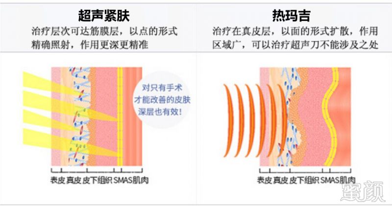 案例图片