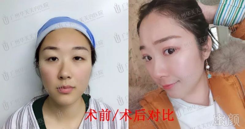 https://img.miyanlife.com/mnt/timg/180326/1206164Y5-4.jpg
