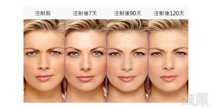 https://img.miyanlife.com/mnt/timg/180326/1211295A7-6.jpg