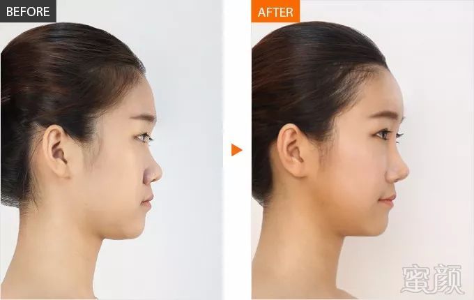 https://img.miyanlife.com/mnt/timg/180326/121U43F8-1.jpg