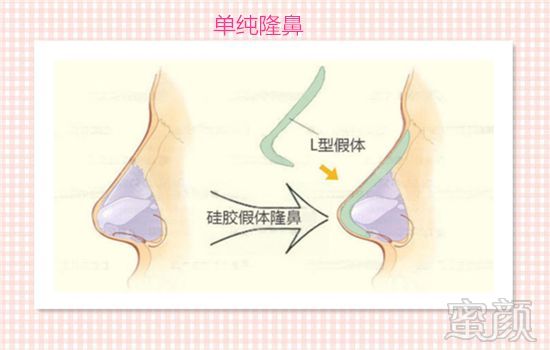 案例图片