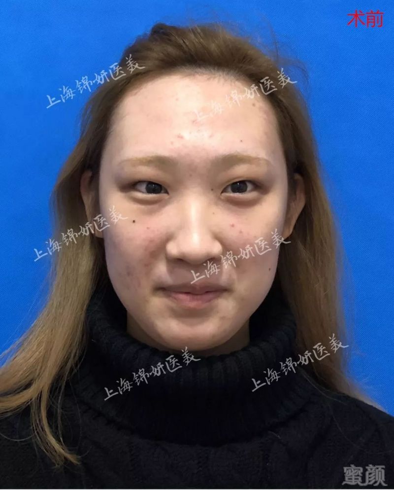 https://img.miyanlife.com/mnt/timg/180326/12224BI1-1.jpg
