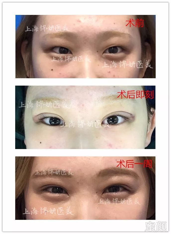 https://img.miyanlife.com/mnt/timg/180326/122254Jc-7.jpg
