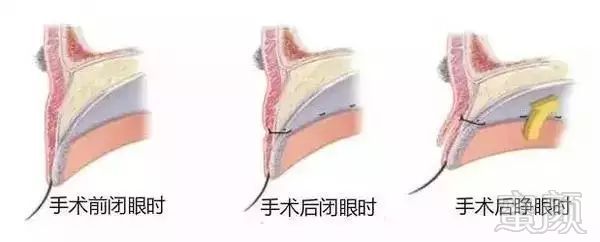 https://img.miyanlife.com/mnt/timg/180326/1223053F4-11.jpg