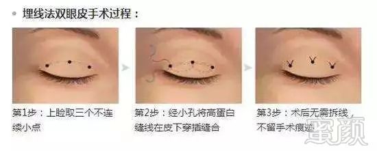 https://img.miyanlife.com/mnt/timg/180326/12230AD7-12.jpg