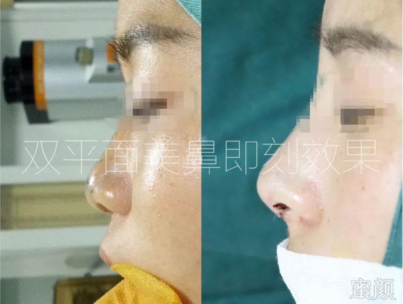 https://img.miyanlife.com/mnt/timg/180326/12243HS9-6.jpg
