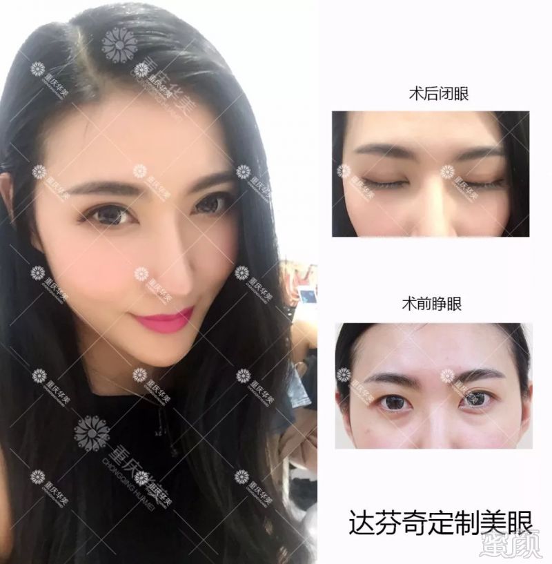 https://img.miyanlife.com/mnt/timg/180326/12252Ib6-1.jpg