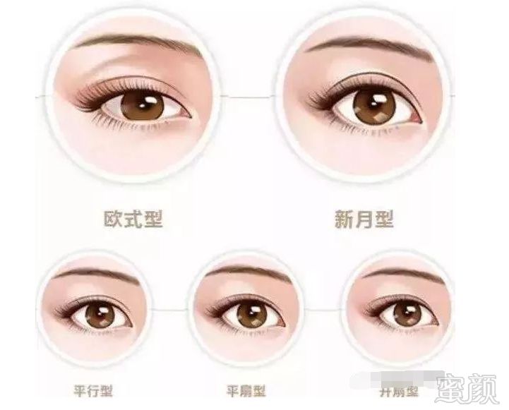 https://img.miyanlife.com/mnt/timg/180327/105232L55-3.jpg