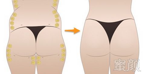 https://img.miyanlife.com/mnt/timg/180327/105KJ0F-1.jpg