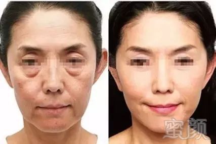 https://img.miyanlife.com/mnt/timg/180327/105KW291-6.jpg