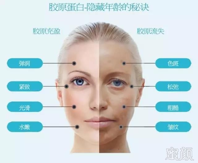 https://img.miyanlife.com/mnt/timg/180327/11325C241-5.jpg