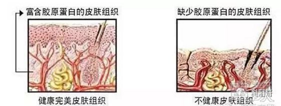 https://img.miyanlife.com/mnt/timg/180327/11325I242-7.jpg