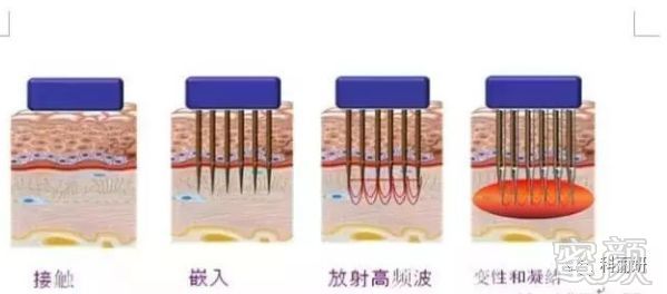 https://img.miyanlife.com/mnt/timg/180327/11325ML6-10.jpg