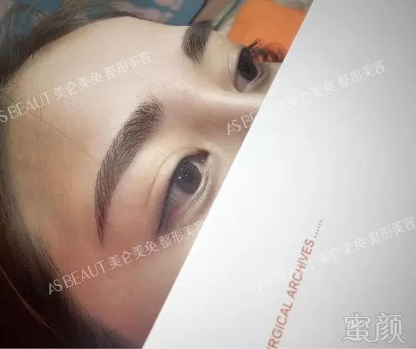 https://img.miyanlife.com/mnt/timg/180327/11424I225-1.jpg