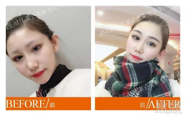 https://img.miyanlife.com/mnt/timg/180327/114250M92-9.jpg