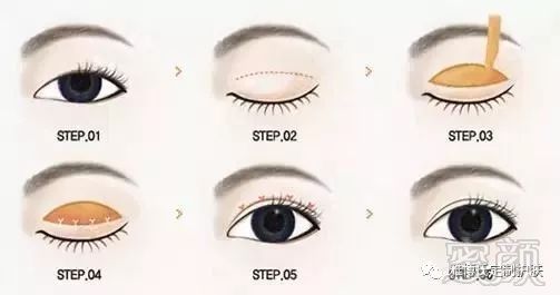 https://img.miyanlife.com/mnt/timg/180327/11500045Z-4.jpg