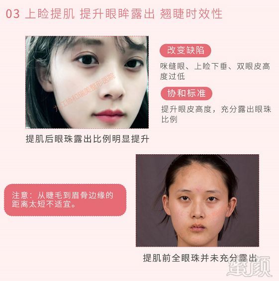 https://img.miyanlife.com/mnt/timg/180327/1205311415-6.jpg