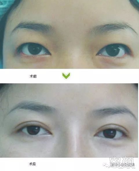 https://img.miyanlife.com/mnt/timg/180327/120I910Q-1.jpg