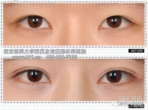 https://img.miyanlife.com/mnt/timg/180327/120I93404-0.jpg