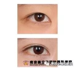 https://img.miyanlife.com/mnt/timg/180327/120J023X-2.jpg