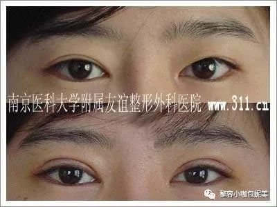 https://img.miyanlife.com/mnt/timg/180327/120J03S6-3.jpg