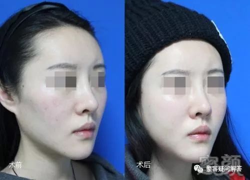 https://img.miyanlife.com/mnt/timg/180327/12200IR6-3.jpg