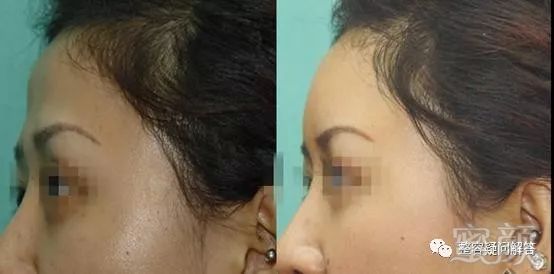 https://img.miyanlife.com/mnt/timg/180327/12200J931-2.jpg