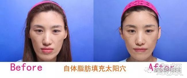 https://img.miyanlife.com/mnt/timg/180327/12200JC4-4.jpg