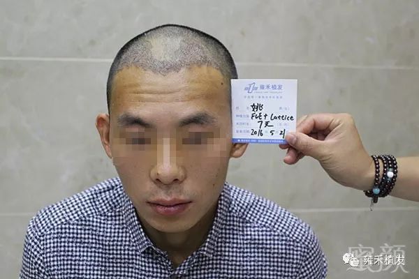 https://img.miyanlife.com/mnt/timg/180327/122255N58-6.jpg