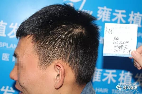 https://img.miyanlife.com/mnt/timg/180327/12225W620-15.jpg