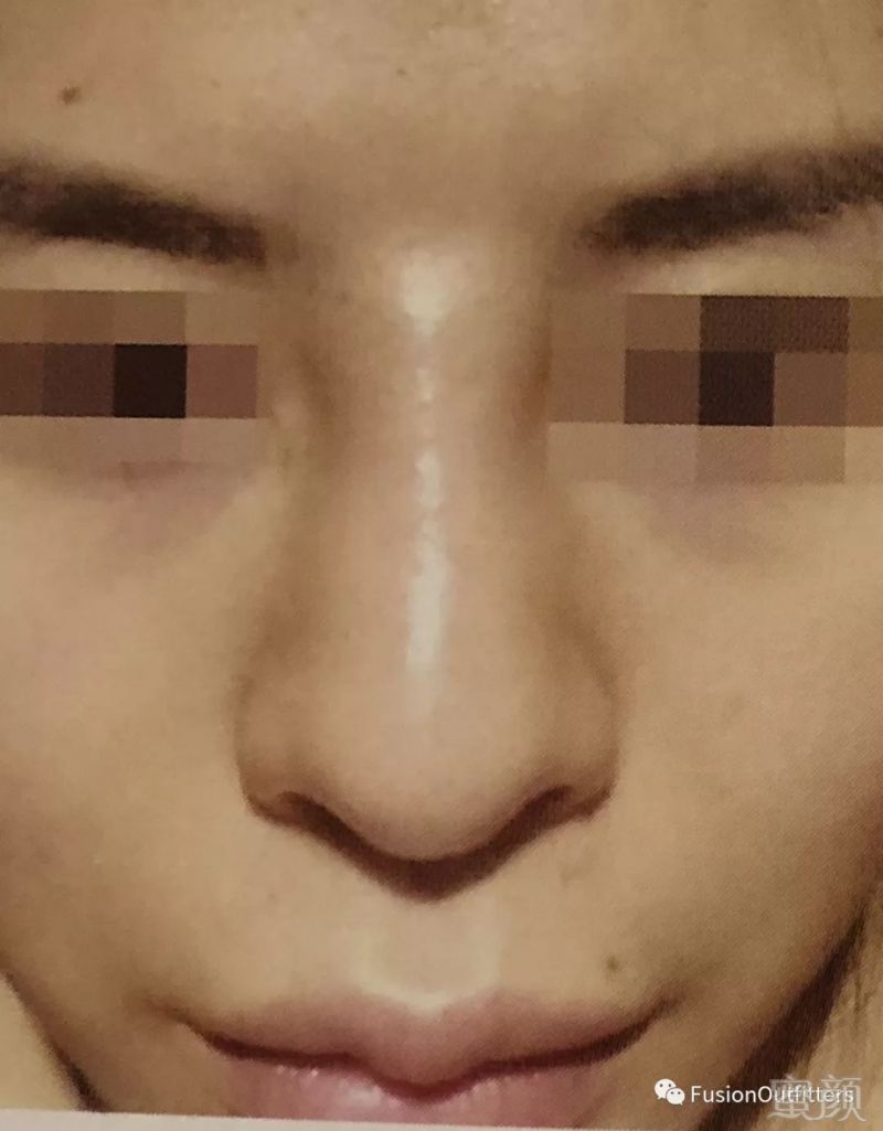 https://img.miyanlife.com/mnt/timg/180327/122ZG351-3.jpg