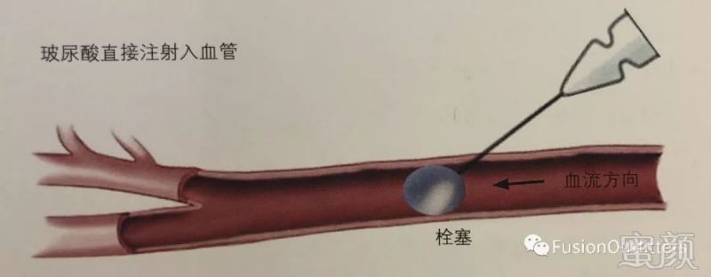 https://img.miyanlife.com/mnt/timg/180327/122ZS1D-4.jpg