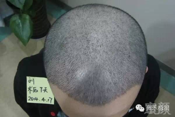 https://img.miyanlife.com/mnt/timg/180327/1231435T1-10.jpg