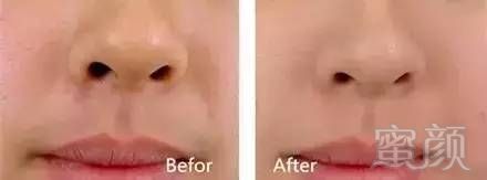 https://img.miyanlife.com/mnt/timg/180328/1112512I9-14.jpg