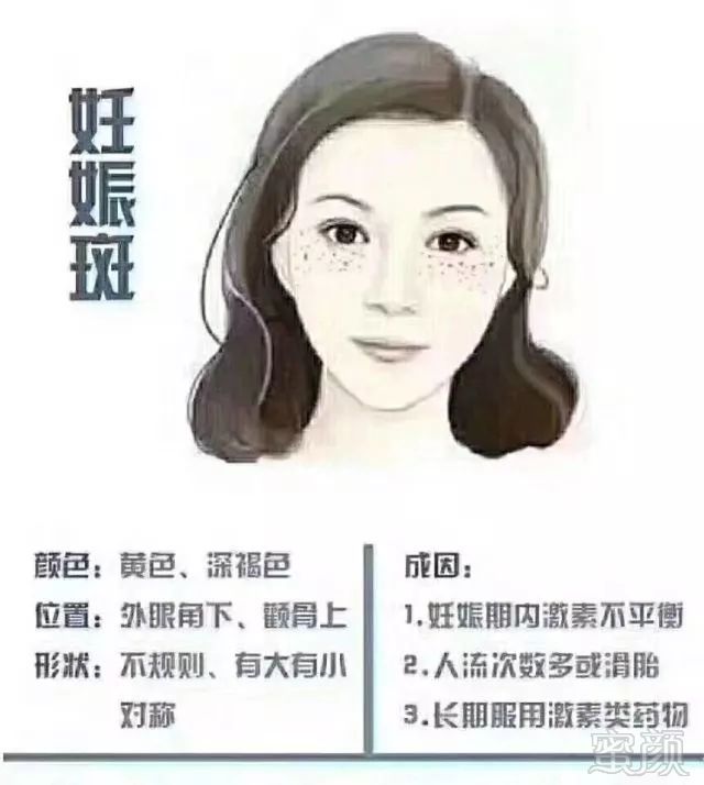 案例图片