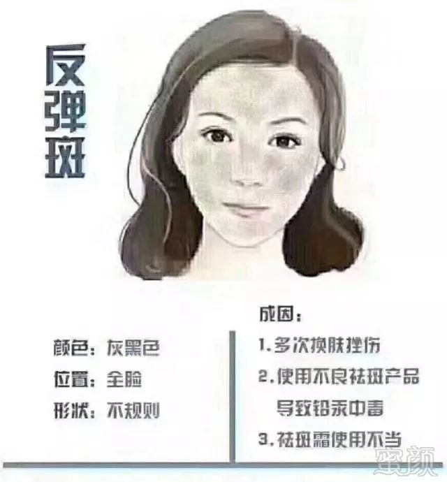 案例图片